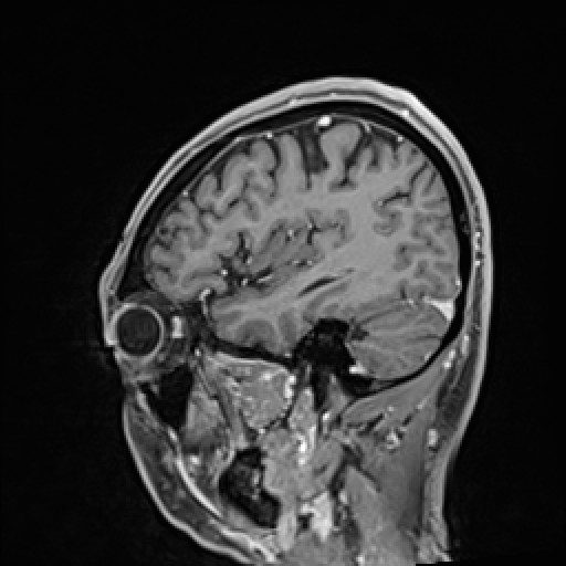 Click on the Serie image to view the images of VILLANUEVA, WILLIAM A.